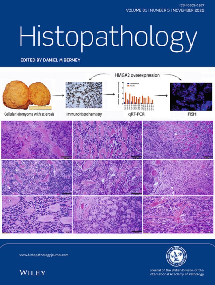 Histopathology Latest Journal Issue Now Available image